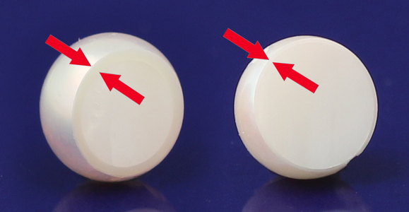 rozdíly v síle perleti